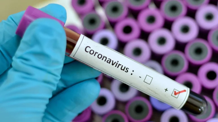 Aumentan casos de COVID-19 en República Dominicana