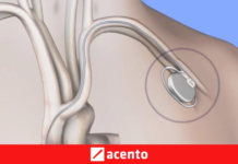 Muerte súbita cardíaca y el uso del desfibrilador implantable ganan respaldo de cardiólogos dominicanos