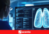 La innovación abre nuevas posibilidades para pacientes con cáncer de pulmón en etapas tempranas