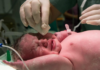 Parto vaginal o cesárea: beneficios y riesgos de las diferentes formas de dar a luz