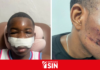 Conductor se da a la fuga luego de accidente con un buggy en Punta Cana dejando dos heridos