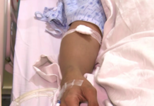 RD registra 19 muertes por leptospirosis en lo que va de año