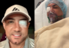 Marcos Yaroide revela fue operado de emergencia por un desprendimiento de retina en su ojo derecho