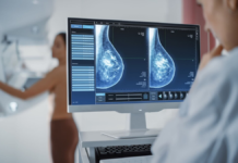 Unas siete mujeres son diagnosticadas con cáncer de mama cada día en República Dominicana