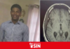 Adolescente de 16 años enfrenta tumor cerebral y pide ayuda para ser pelotero