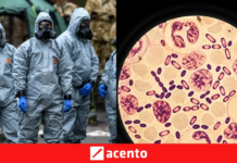 OMS pide transparencia a Rusia tras muerte en centro de investigación de peste