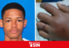 Joven de 19 años resulta herido por descarga eléctrica en Sabana Grande de Boyá