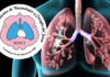 Sociedad de Neumología anuncia curso de rehabilitación pulmonar